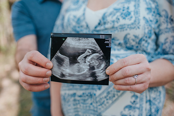 babycaseymaternity-82