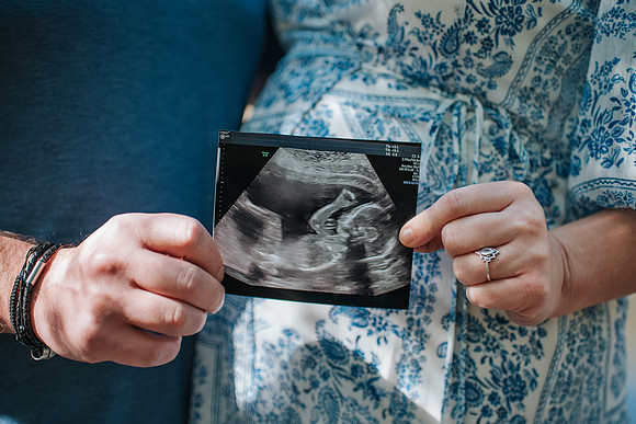 babycaseymaternity-38
